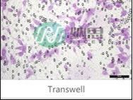 Transwell實驗